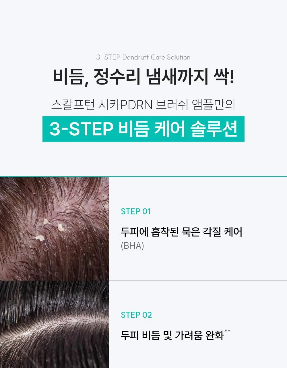 [포켓몬 에디션][비듬/각질케어]릴리이브 스칼프턴 시카 PDRN 브러쉬 앰플 100ml 2종 택1 상세페이지 28